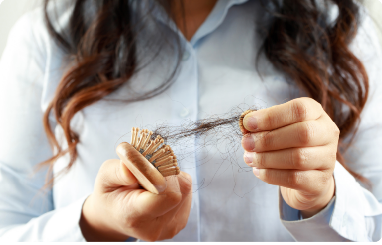 Close-up view of a woman holding a hairbrush filled with strands of hair, symbolizing hair loss.