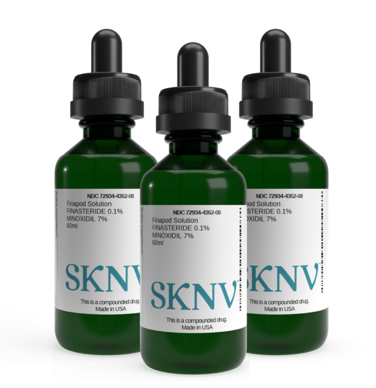 Three green glass bottles with droppers filled with SKNV customized hair loss treatments, labeled with active ingredients finasteride and minoxidil.